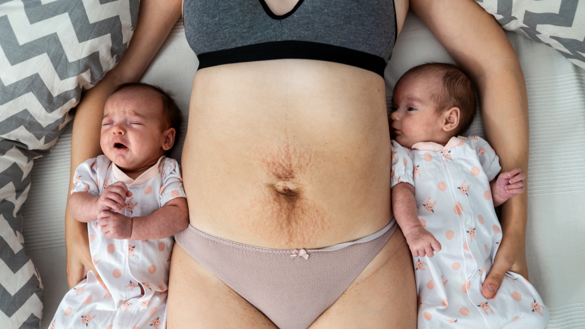 Authentic photo campaign shows the unfiltered reality of postpartum life